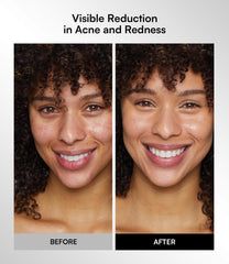 INIA silicone mask remains skin-friendly and easy to clean.