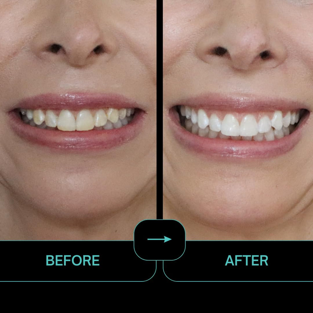 Intelliwhite ProStrips closeup whitening action on enamel for brighter look.