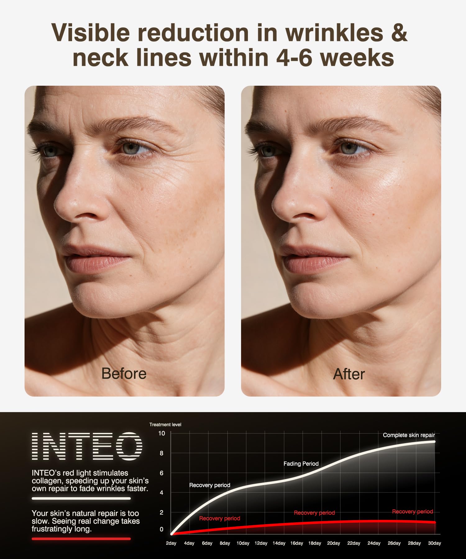 INTEO four modes deliver infrared, red, orange, and blue wavelengths for versatility.