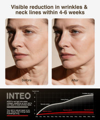 INTEO four modes deliver infrared, red, orange, and blue wavelengths for versatility.