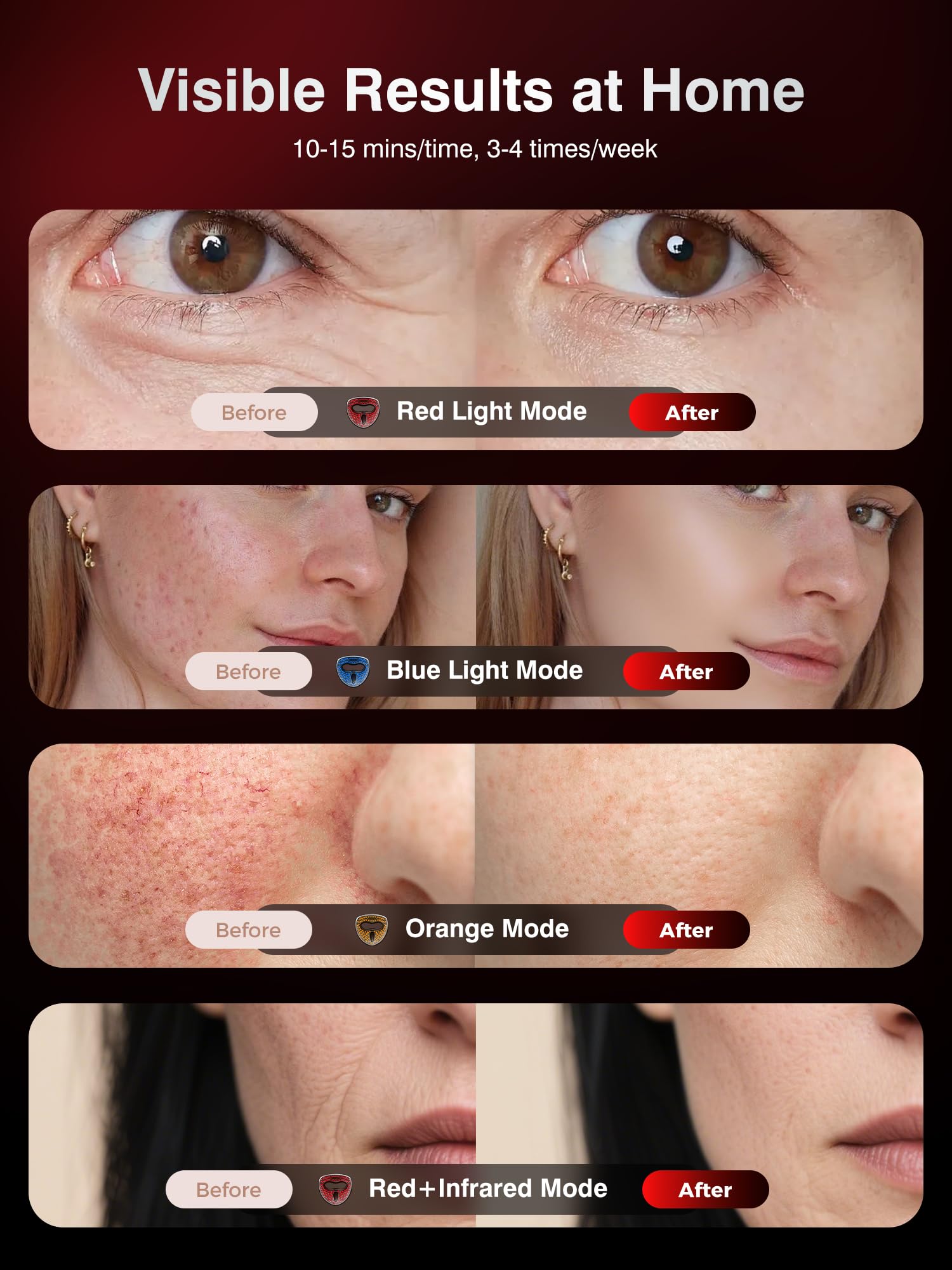 INTEO 328 high-energy LEDs ensure dense coverage on the face.