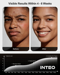 INTEO yoga-mat session with light therapy for gentle recovery