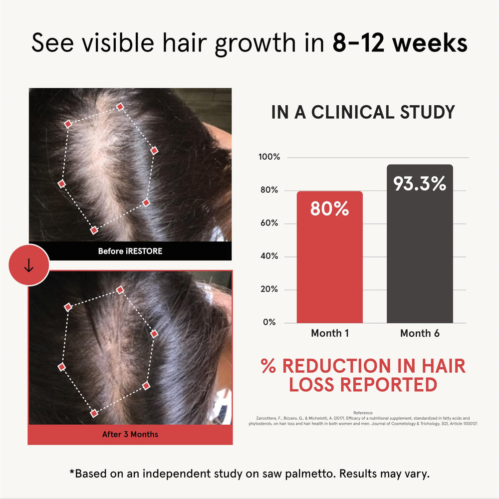 iRestore bottle pour demonstrates simple 3-capsule daily dosing for ongoing hair support.