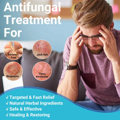 Ishancare Antifungal Cream texture on skin illustrates smooth absorption for quick relief.