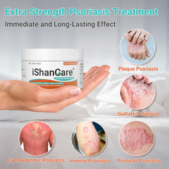 Texture of Ishancare Psoriasis Cream being applied to skin for soothing relief