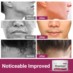 ishancare cream on scalp indicating targeted relief