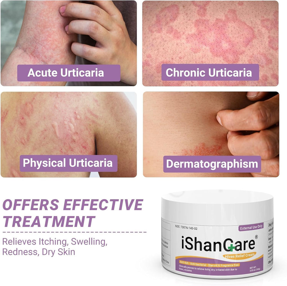 ishancare Urticaria Cream bottle pour demonstrates fast absorption on skin