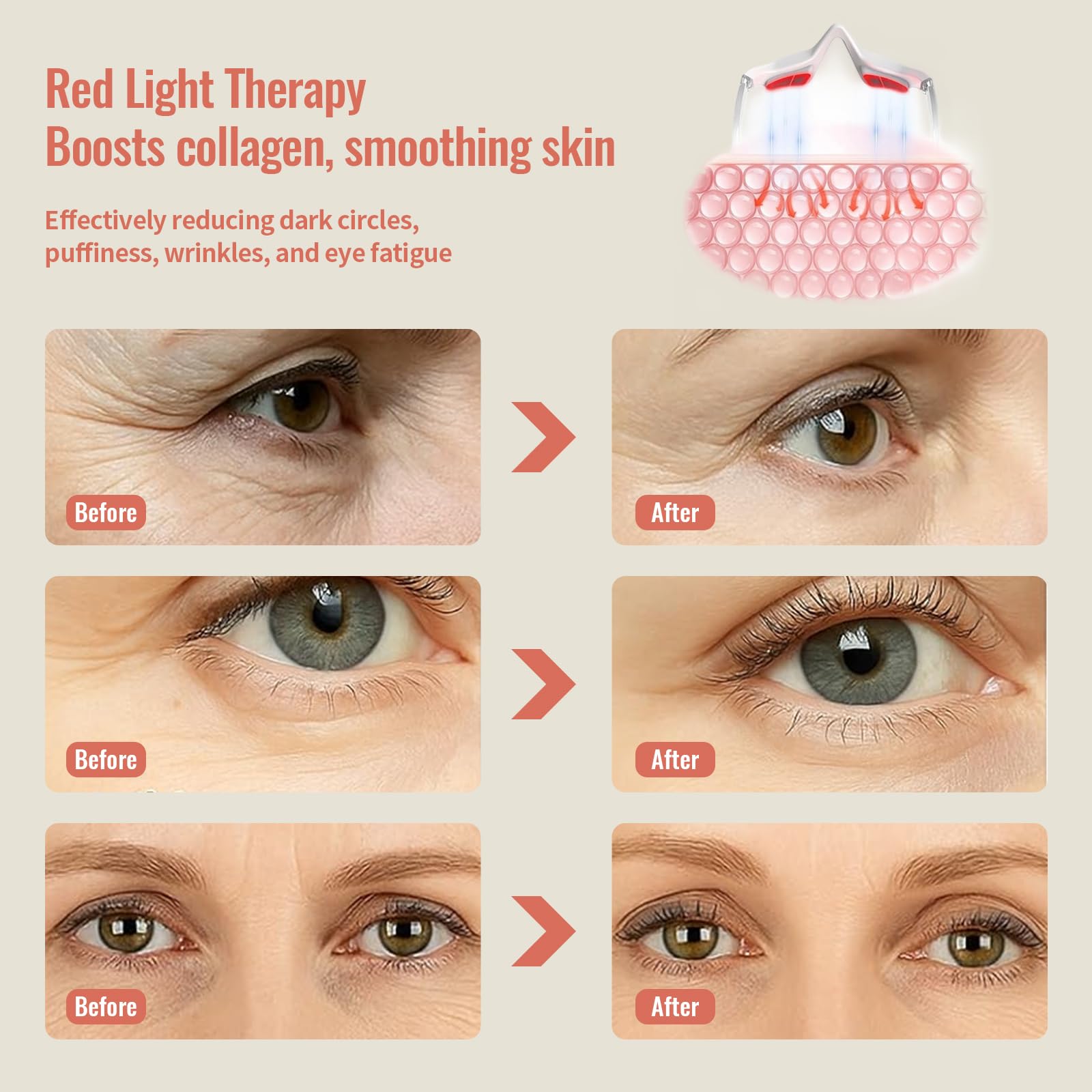 JCOTTON microcurrent eye massage targets puffiness around the eyes