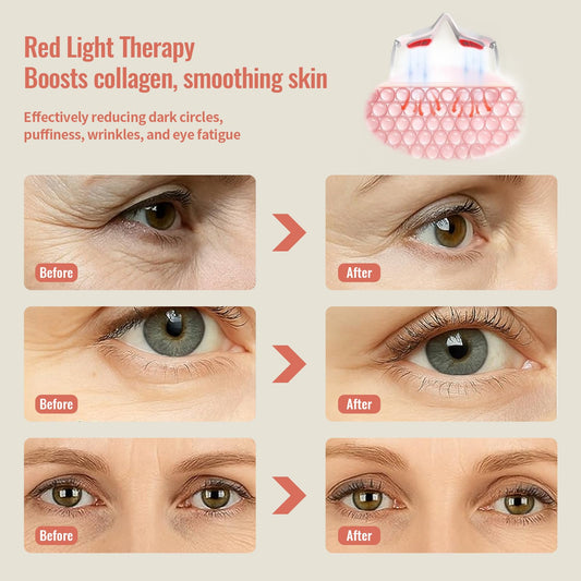 JCOTTON microcurrent eye massage targets puffiness around the eyes