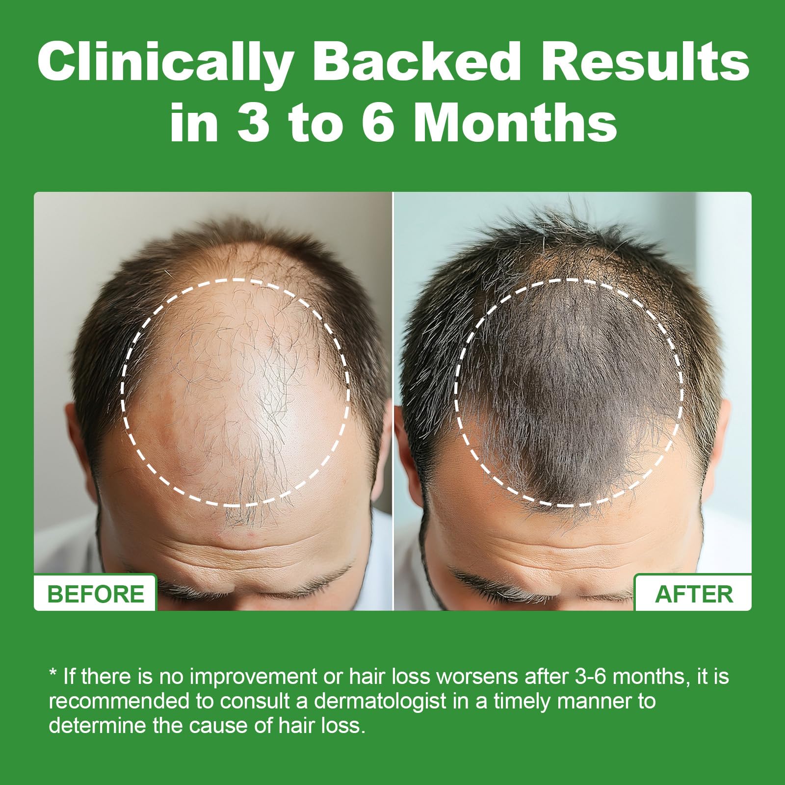 JOVITHEA hair growth visuals suggest stronger strands over time