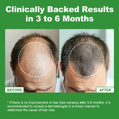 JOVITHEA hair growth visuals suggest stronger strands over time