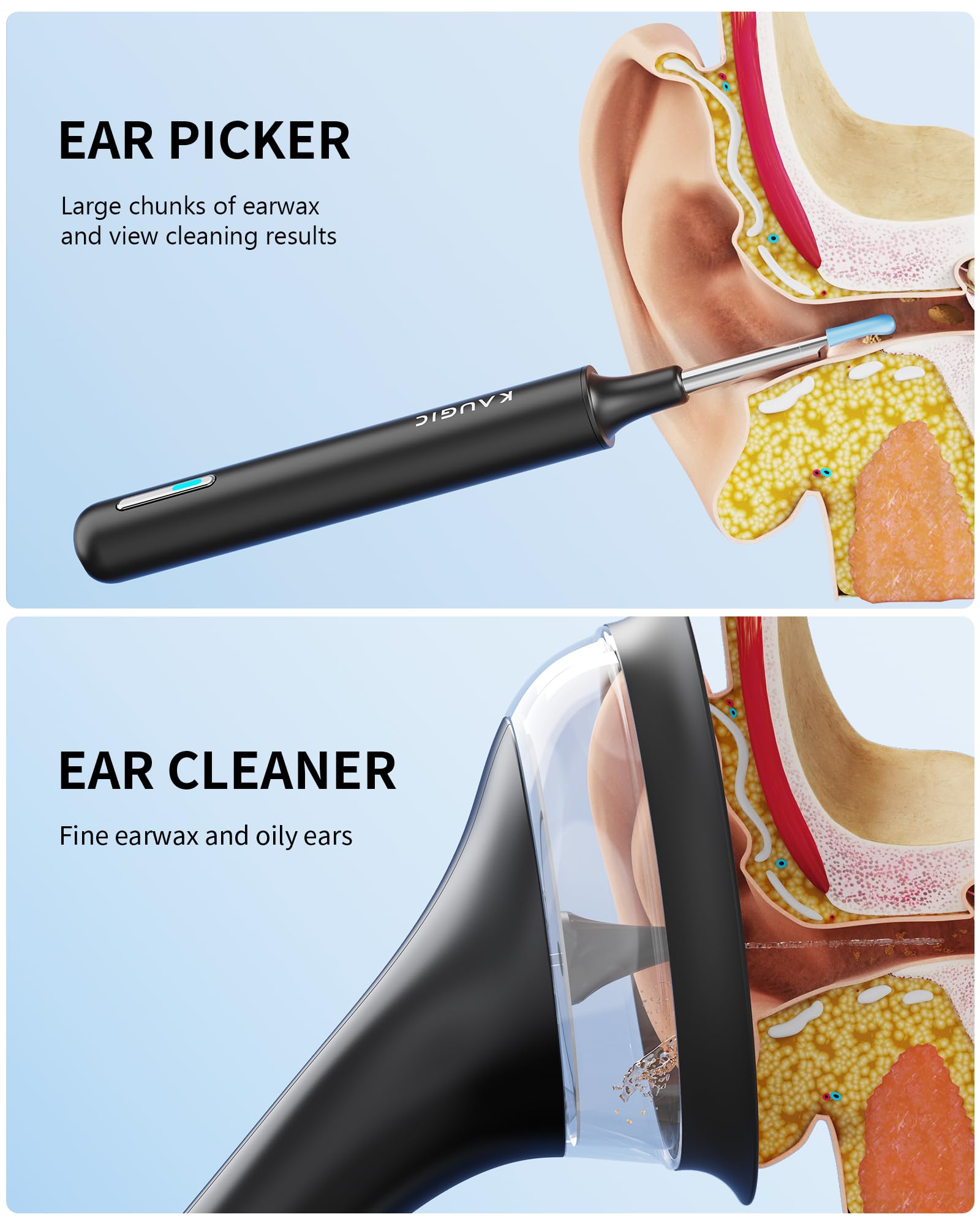 KAUGIC ear-cleaning-kit-contents visible, including tips and syringes for versatile care.