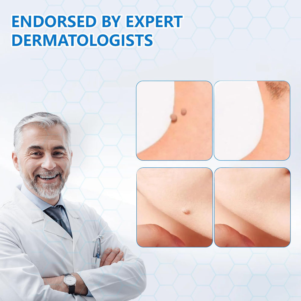 KIbabyDI Wart Remover Gel applicator enables precise at-home wart treatment.