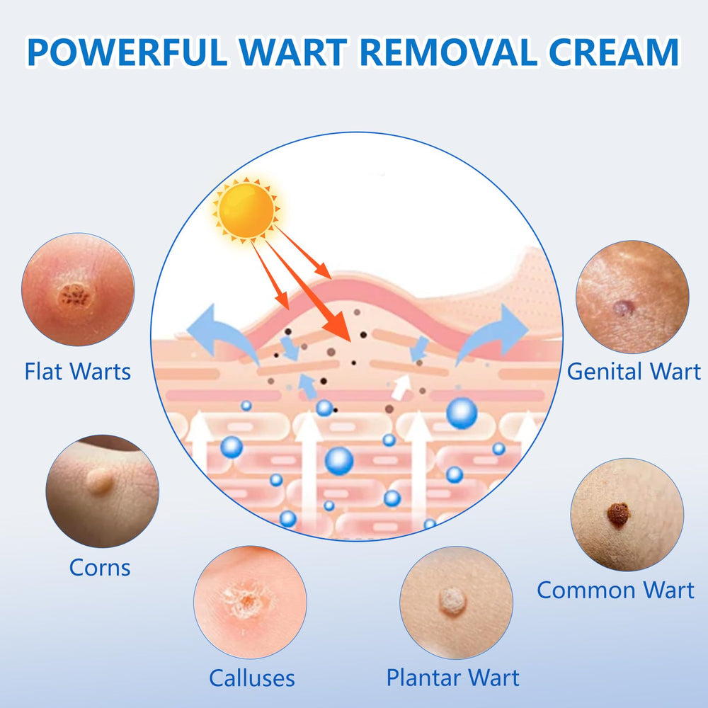 KIbabyDI Freeze-off technology targets warts for non-invasive removal at home.