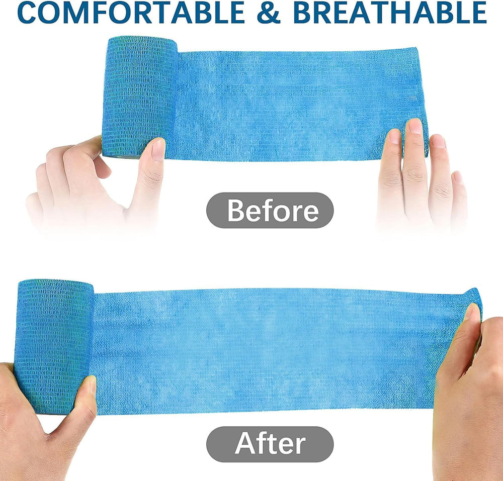 KisSealed bandage wrap with individual packaging keeps rolls clean and portable
