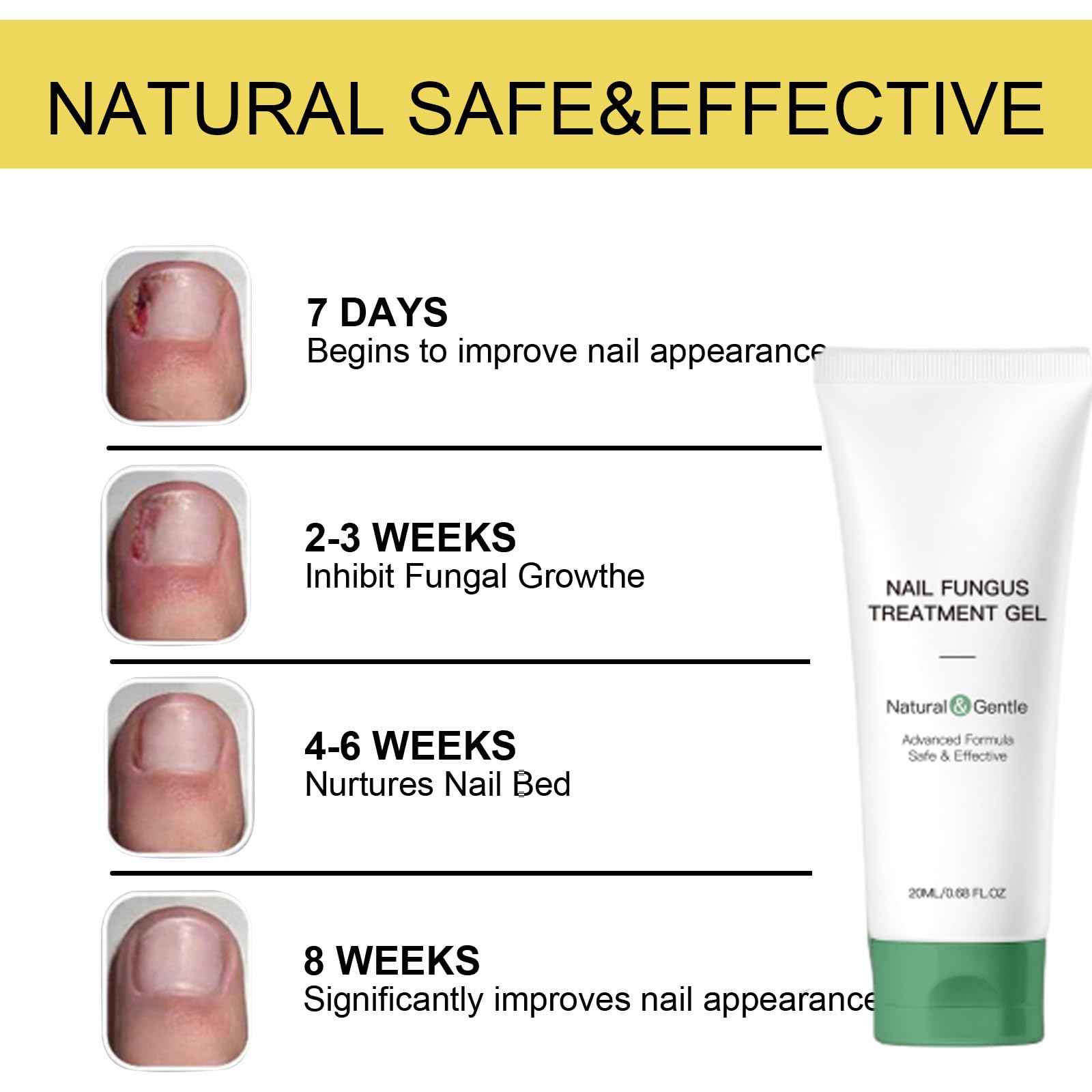 KUNLEN gel hydration effect; nourishes nail surface.