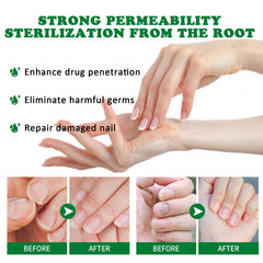KUNLEN gel restores natural shine to nails.