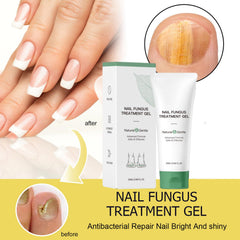 KUNLEN Nail Fungus Gel texture close-up; smooth application ready.