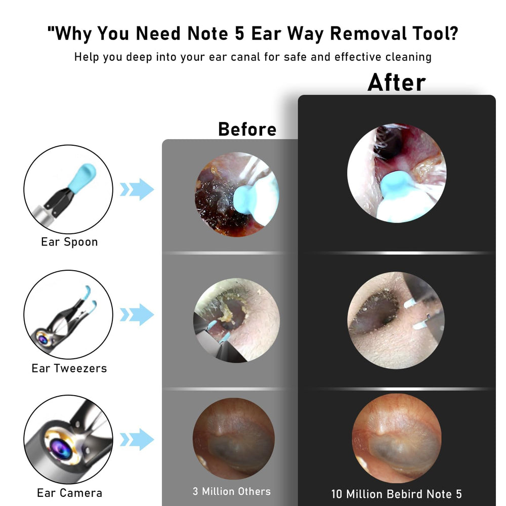 KWYBOW Note5 ear pick tweezers allow safe extraction of debris.