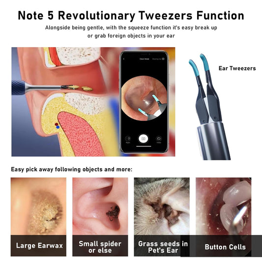 KWYBOW Note5 otoscope with light illuminates the ear canal for precise inspection.