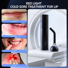 LaseLocks single-button operation allows quick, simple therapy sessions.