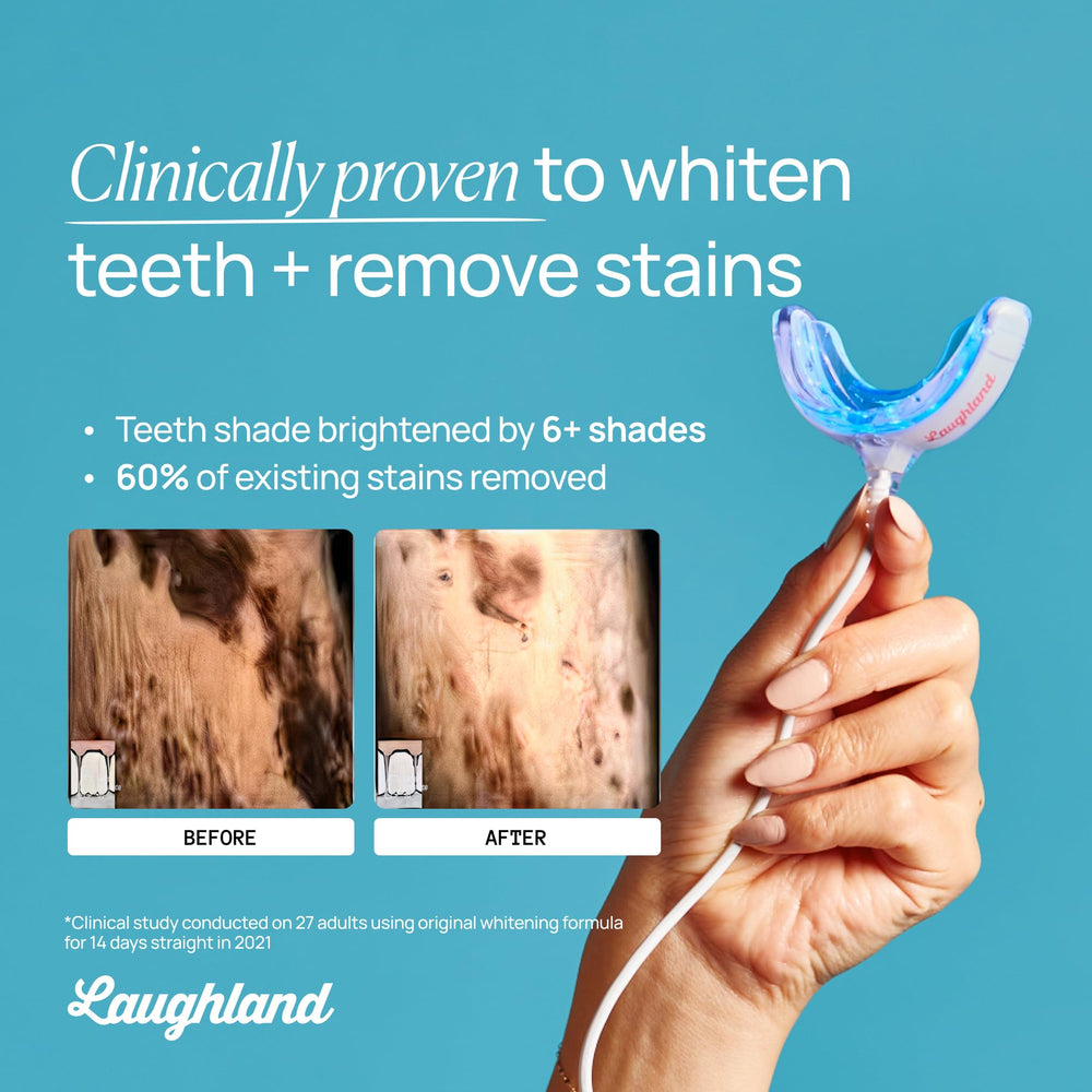 Laughland Original Teeth Whitening Kit phone-powered LED mouthpiece on the go.