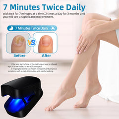 7-minute session timer on Leeyond device for efficient care