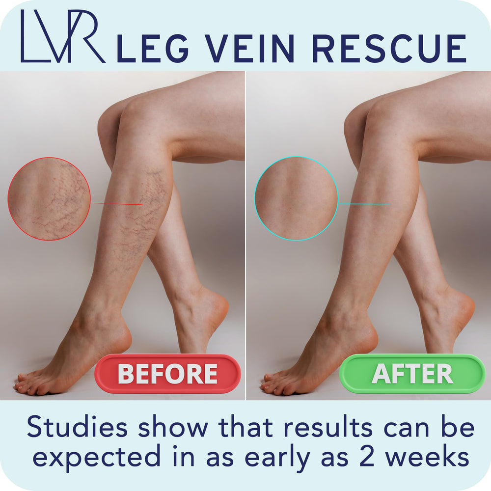 LEG VEIN RESCUE night-time comfort may ease leg discomfort