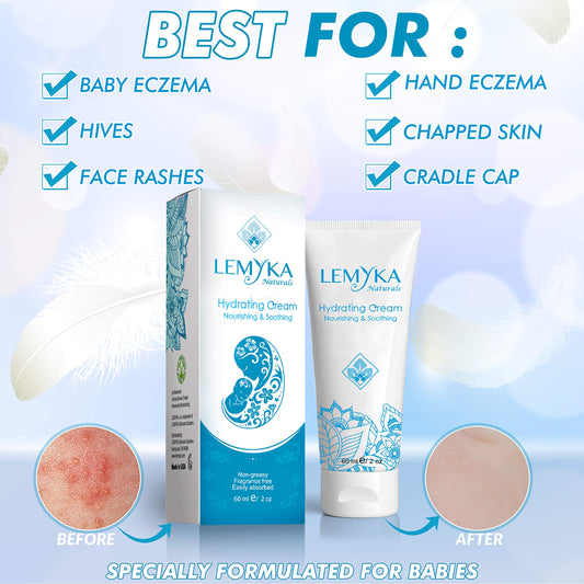 LEMYKA Eczema Cream texture close-up showing non-greasy hydration