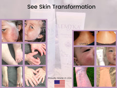 LEMYKA baby-safe formula gentle on delicate skin