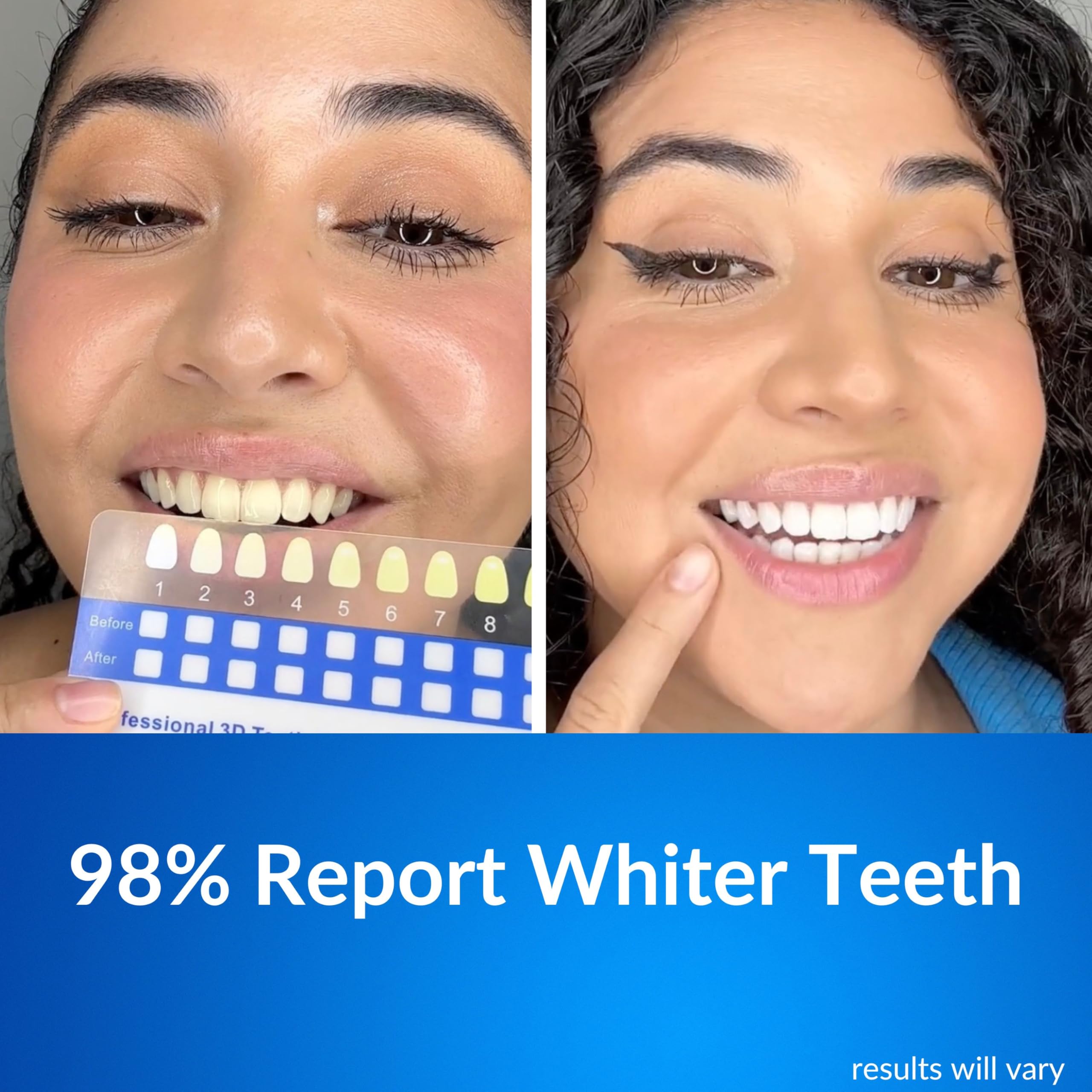 LeVaye Polar MD home whitening setup enables convenient whitening.