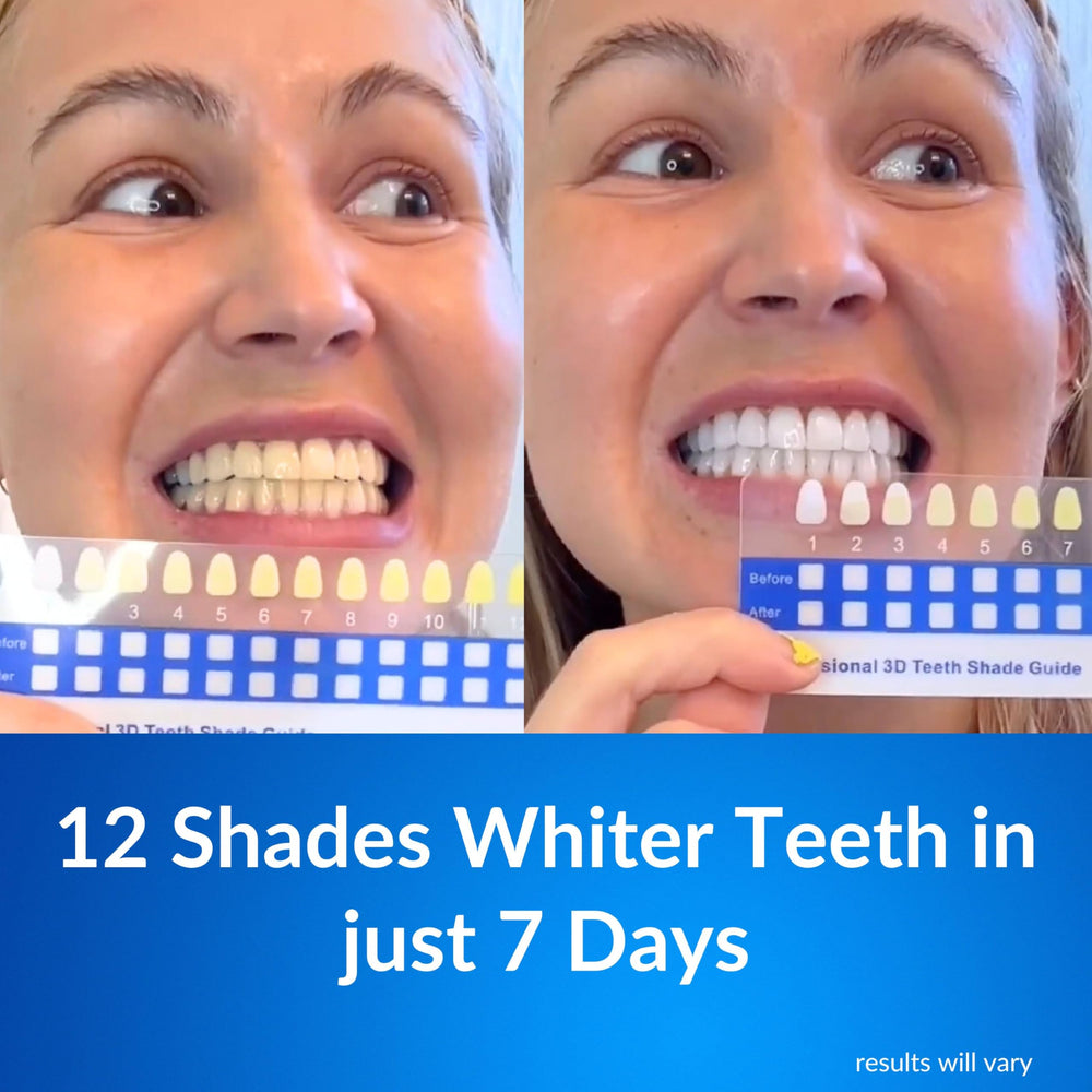 LeVaye Polar MD light activator with 32 LEDs for faster whitening sessions.