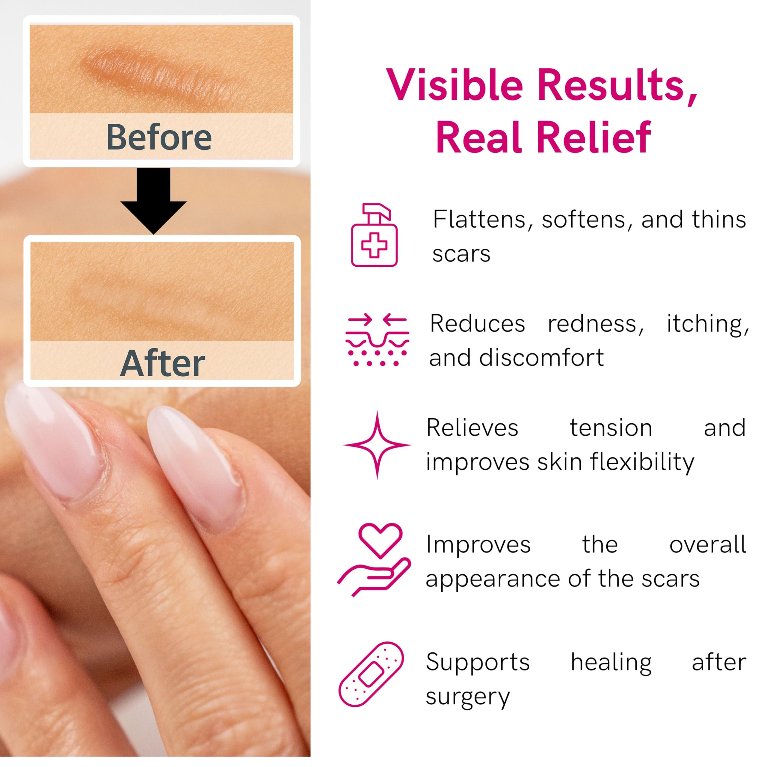 LIPOELASTIC compact tube packaging for easy on-the-go scar care.