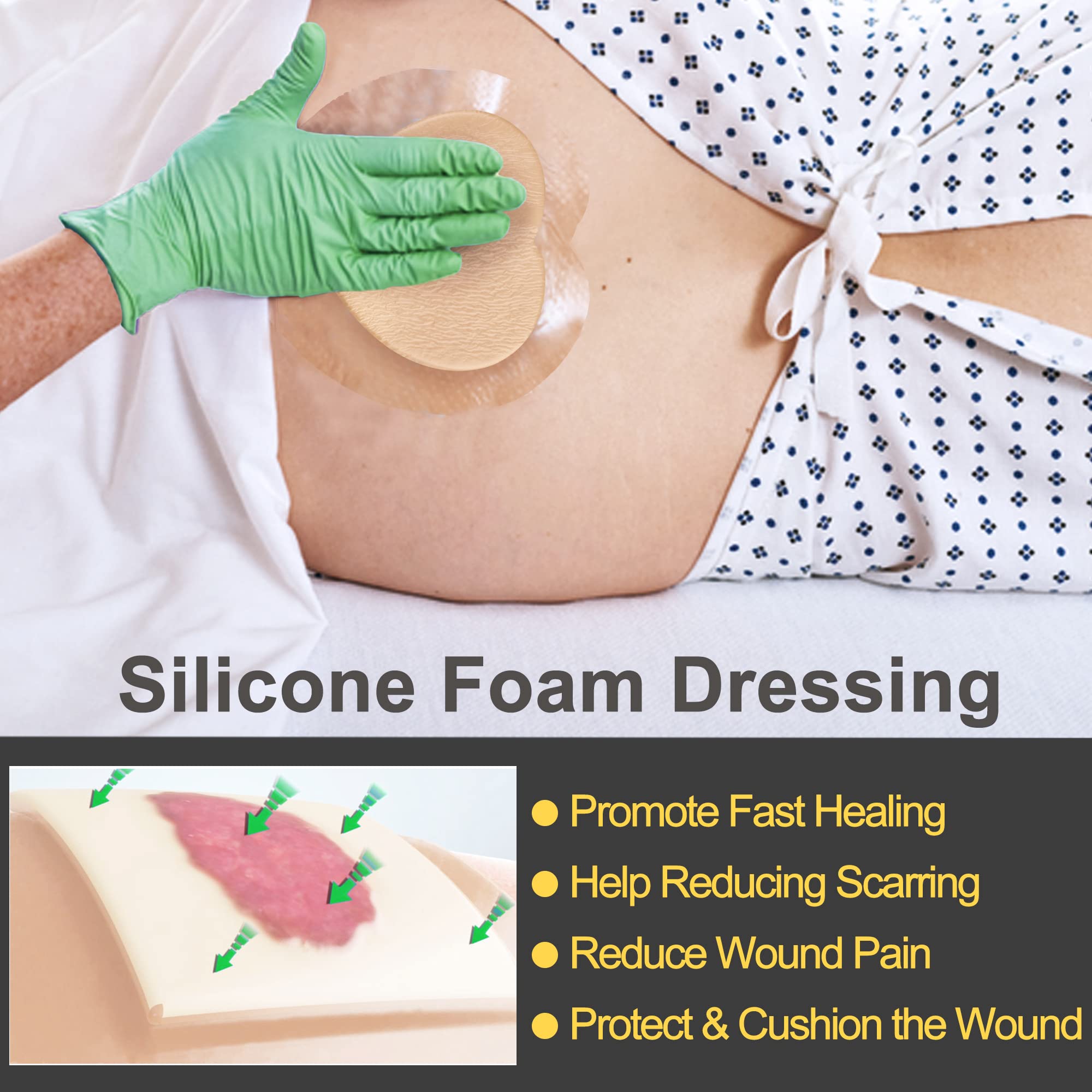 LotFancy silicone wound contact layer reduces sticking to moist wounds
