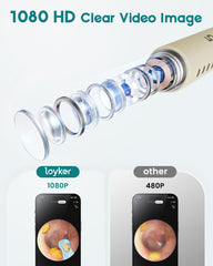Loyker ear canal is illuminated by 6 LED lights for clear inspection.