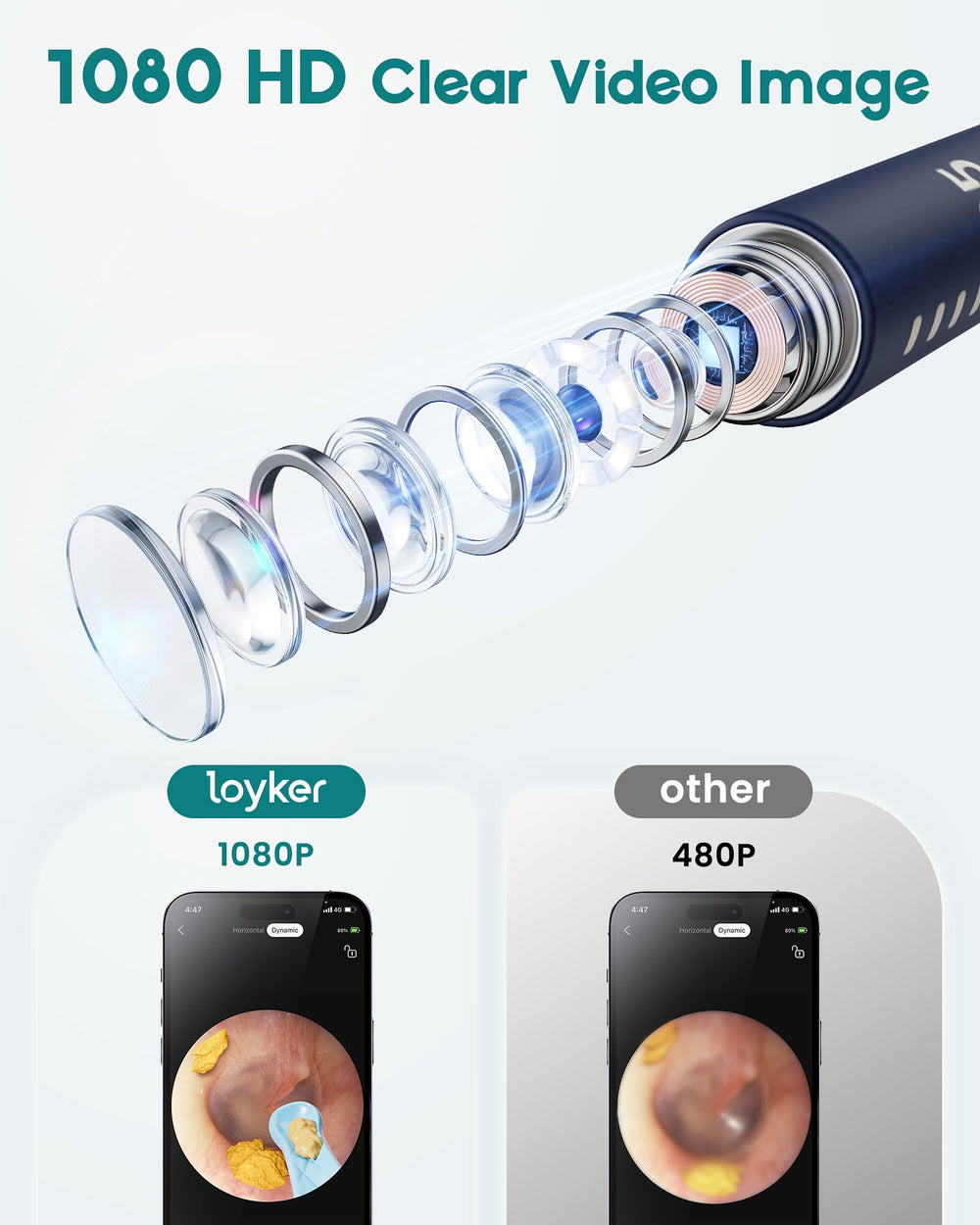 Loyker ear canal modes provide gentle options for different cleaning needs
