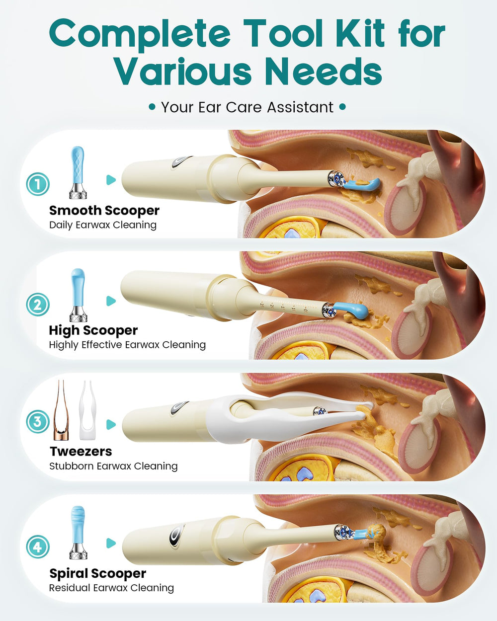 Loyker cleaning kit includes 12 tips for versatile ear canal access.