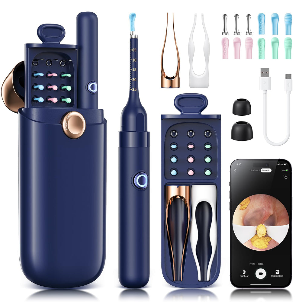 Loyker ear wax removal camera view shows clear ear inspection with 1080P detail
