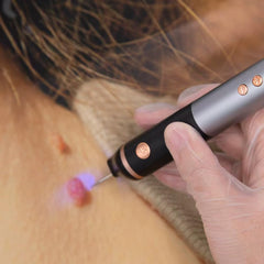 Lrxveio Skin Clinic compact handheld design for easy at-home use