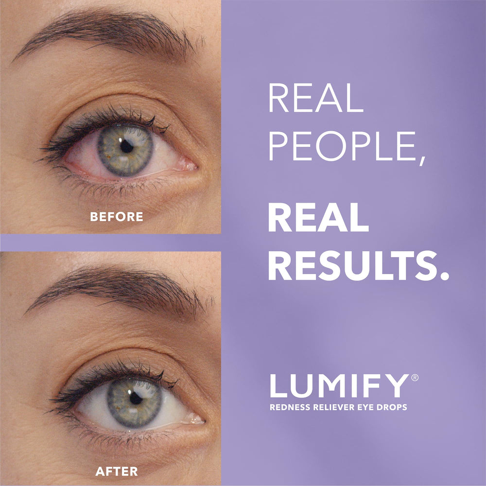 Lumify up to 8 hours of whitened, brighter-looking eyes