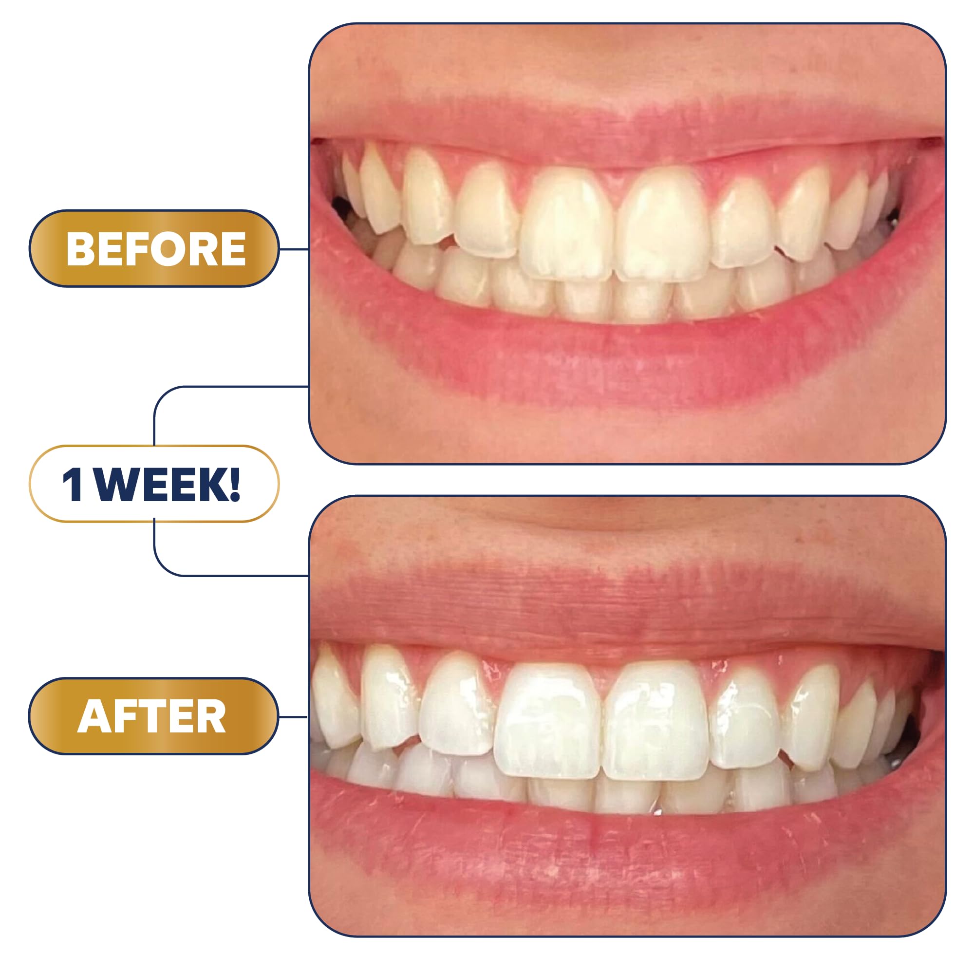 Lumineux Longevity daily routine setup for a brighter smile