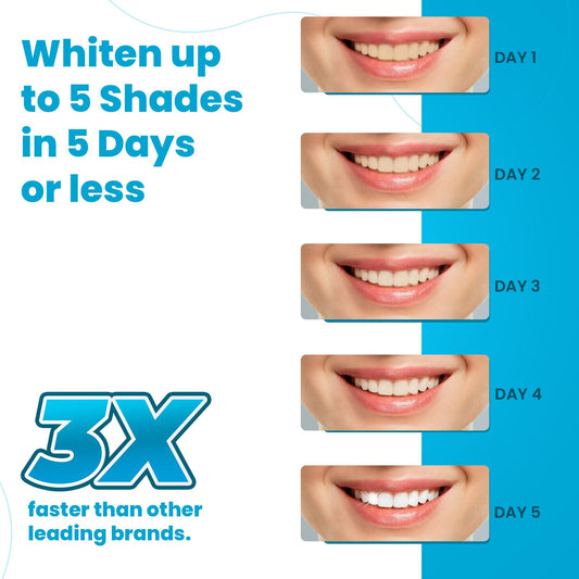 Lumist Advanced Teeth Whitening Strips application closeup demonstrates comfortable fit for even coverage