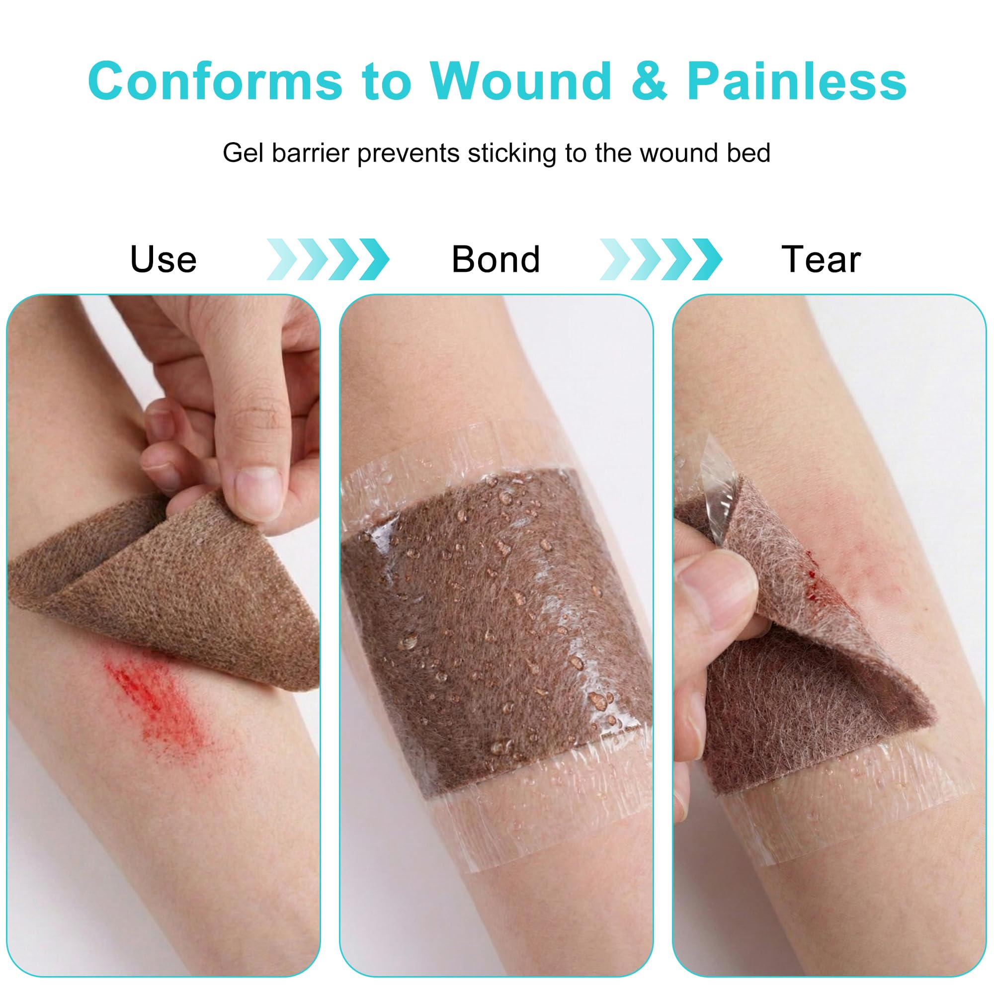 Lvonge single-use wound patch packaging ensures sterile, convenient replacement