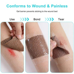 Lvonge single-use wound patch packaging ensures sterile, convenient replacement