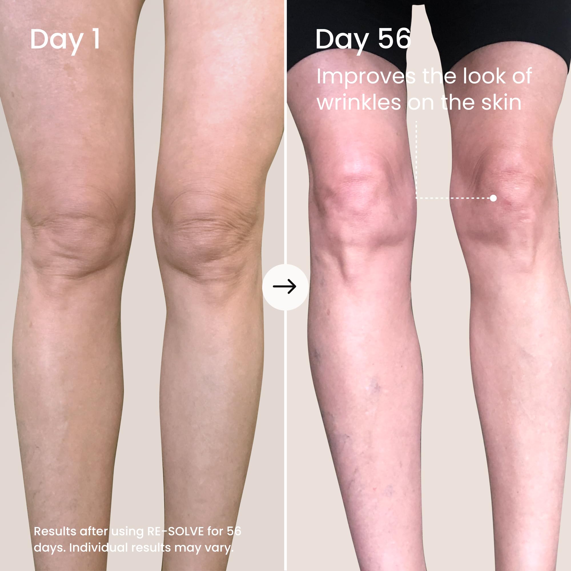 MAËLYS RE-SOLVE arm application demonstrates quick absorption.