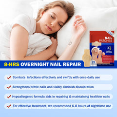 Mcukv toenail patches with natural plant extracts for gentle, non-irritating care.