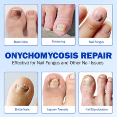 Mcukv toenail patches sleep-care routine fits nightly schedule.
