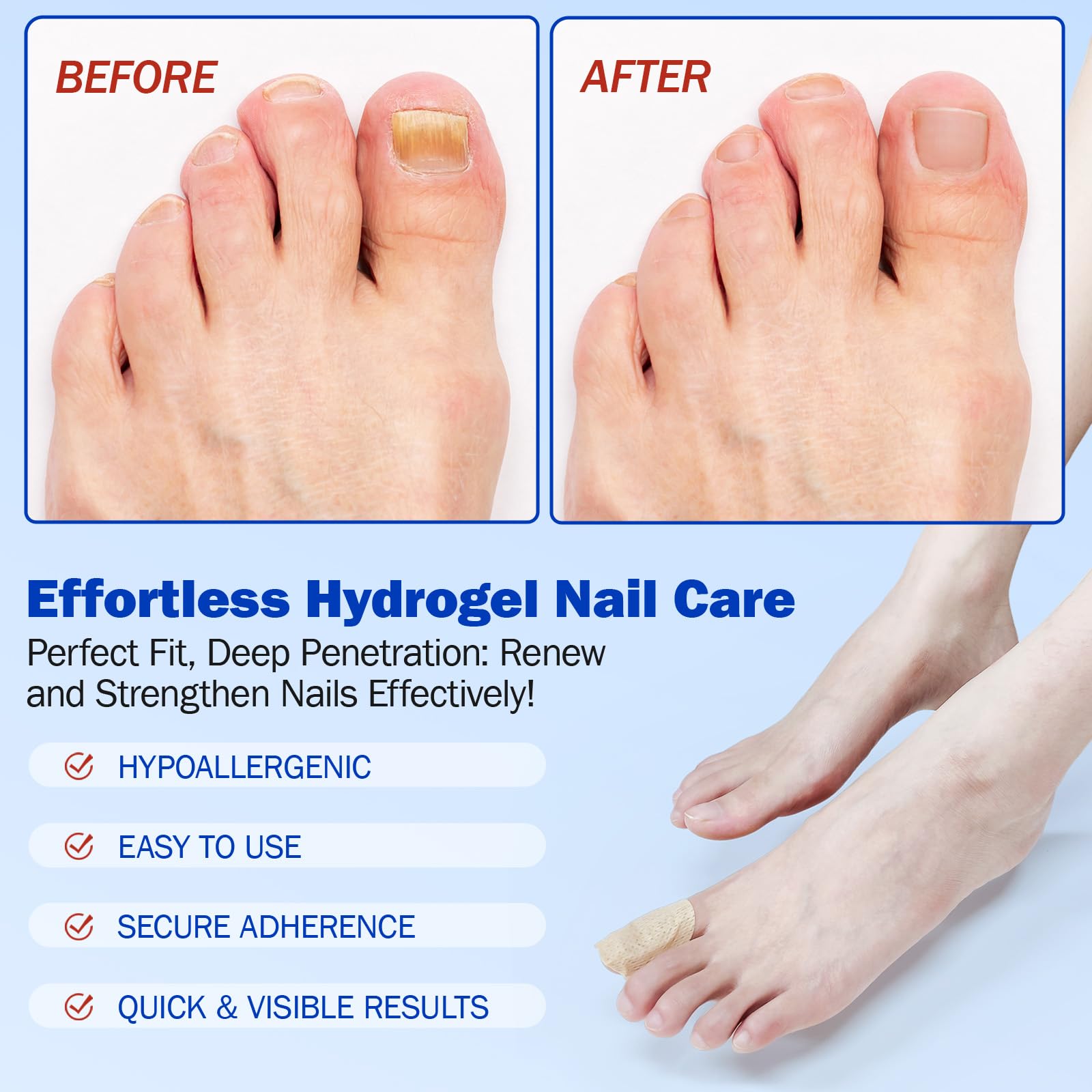 Mcukv toenail patches travel-friendly pack for on-the-go maintenance.
