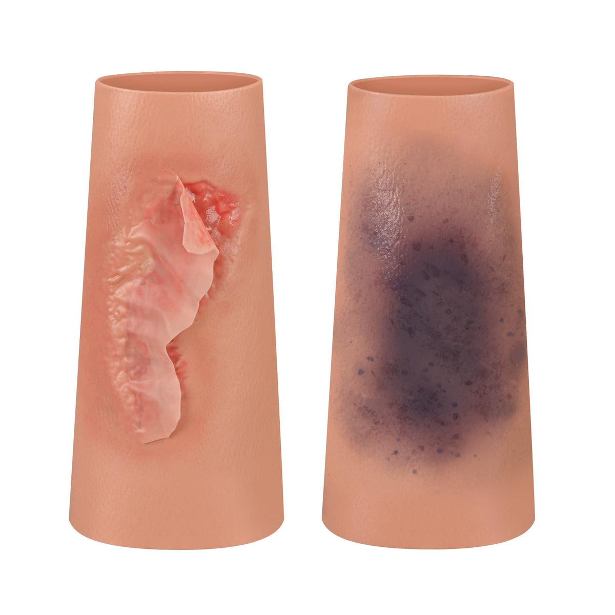 MedEduQuest abrasion wound sleeve for realistic training practice of wound care.