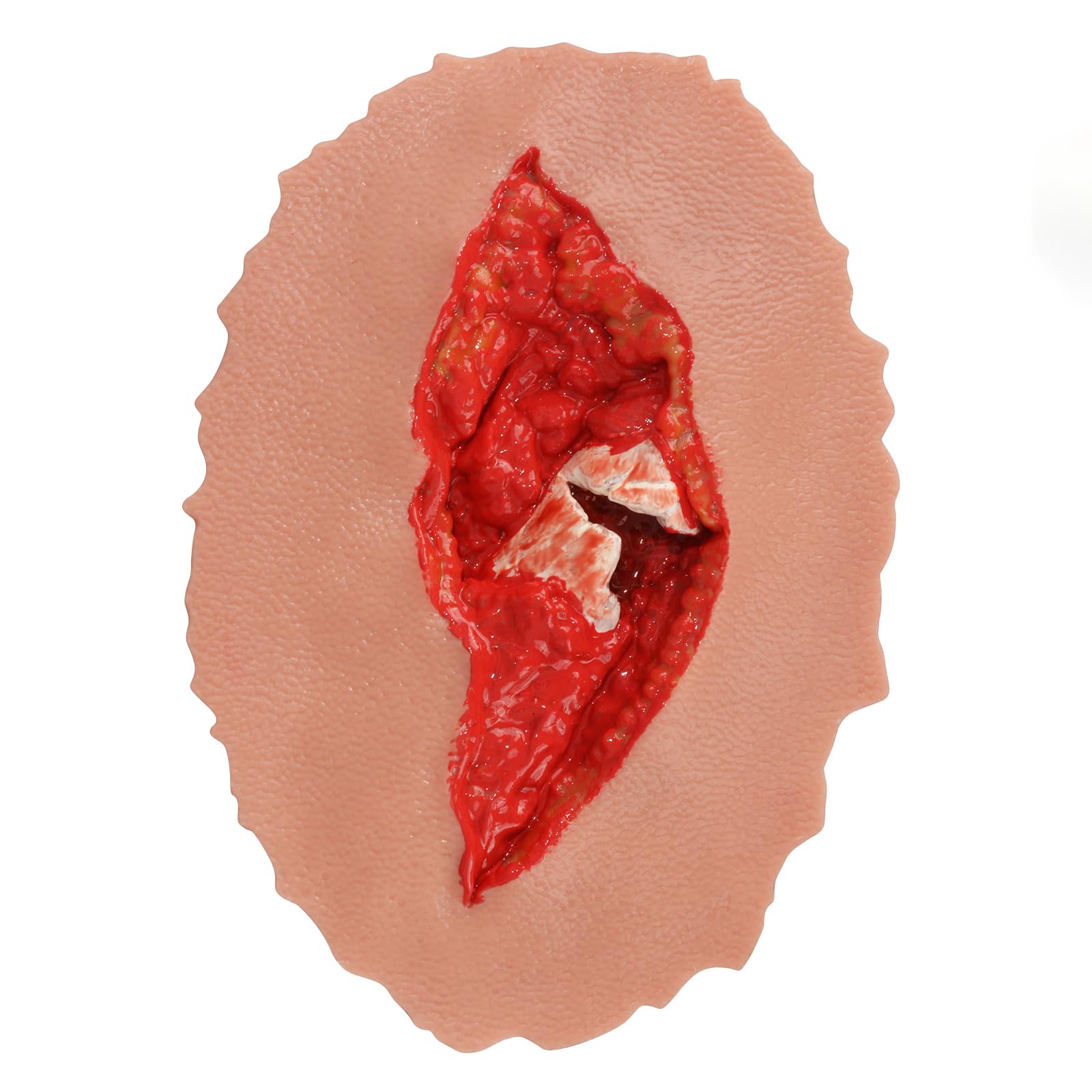 MedEduQuest Open Fracture Wound Trainer offers lifelike practice for open fracture care